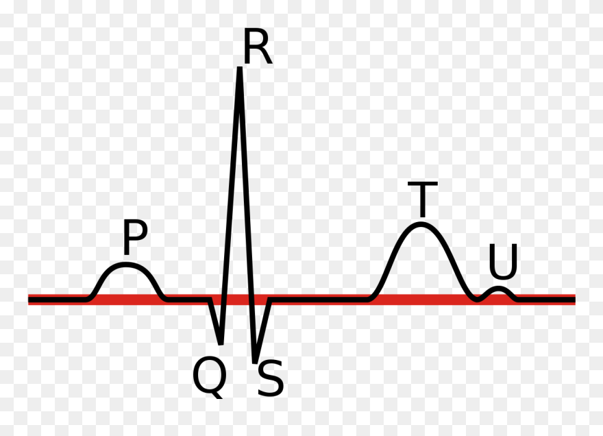 Ecg Wave Png Clipart