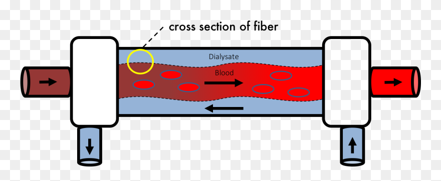 High Flux Dialysis Clipart