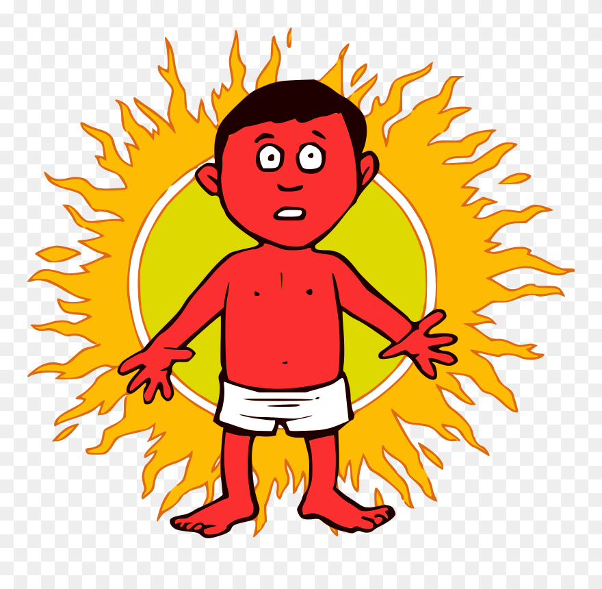 Sunburn Clipart Sunburn Man - Sunburn Clipart - Png Download