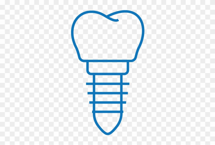 Dental Implant Clipart