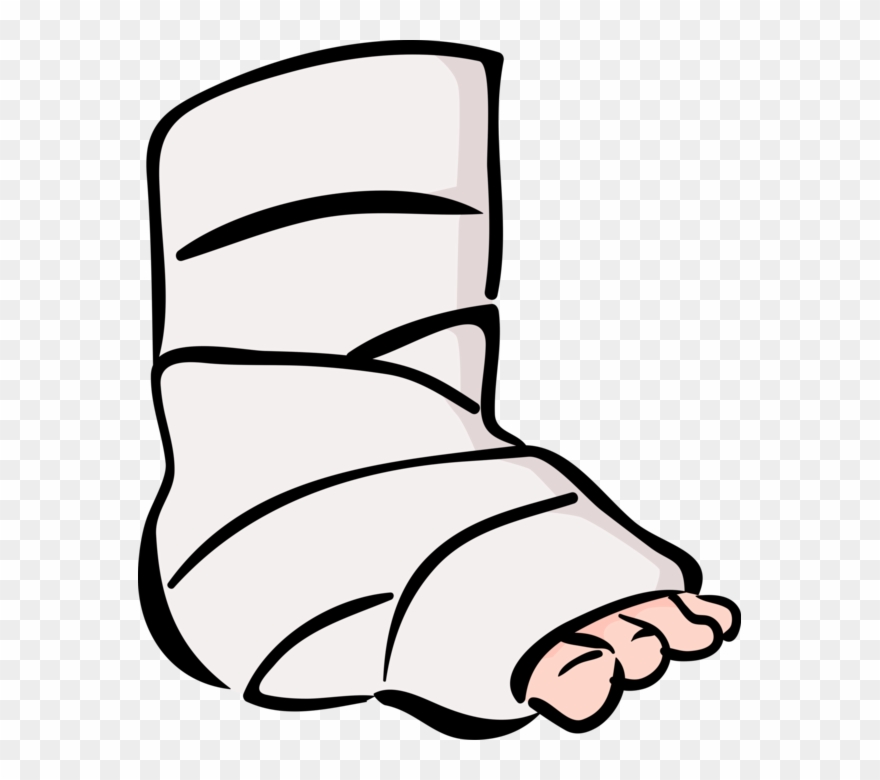 Accident Patient With Ankle Vector Image Illustration - Transparent Broken Leg Clipart - Png Download