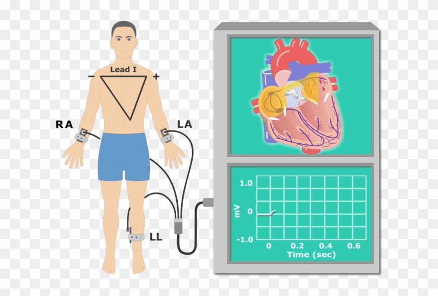 The P Wave Ekg Recording Animation Slide - Ecg Cartoon Clipart