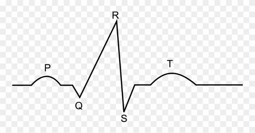 Open - Ekg Diagram Clipart