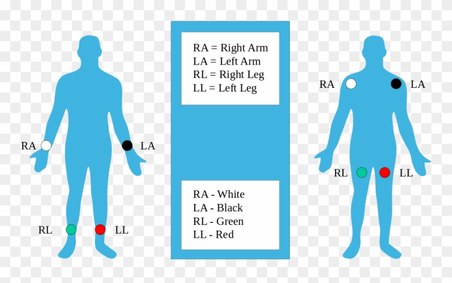 Ekg Clipart Ekg Strip - Ra La Ll Rl - Png Download