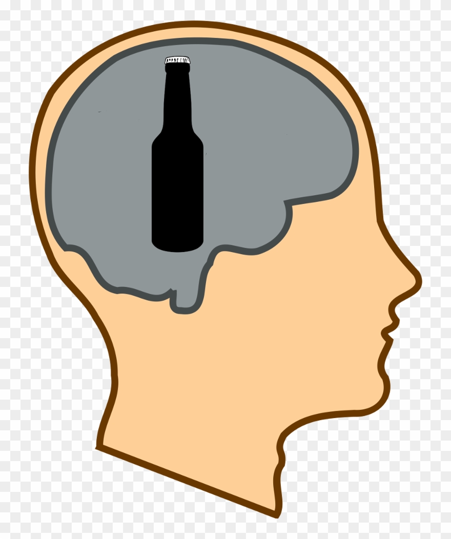 Dumb - Brain Clip Art - Png Download