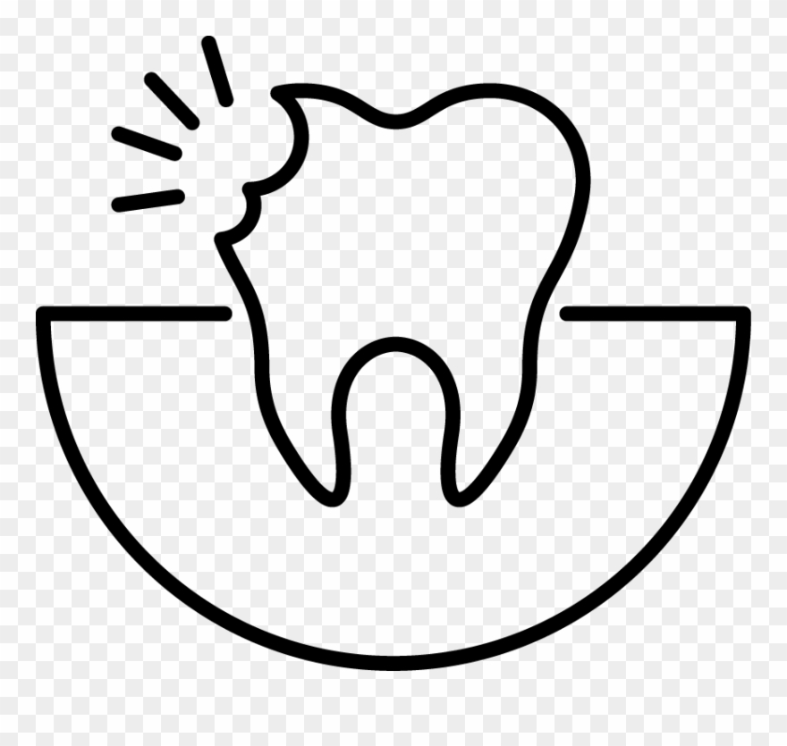 Our Dental Plan - Endodontic Therapy Clipart