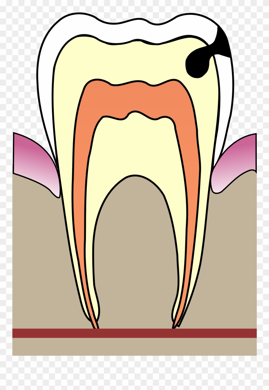 Open - Cavities Clipart