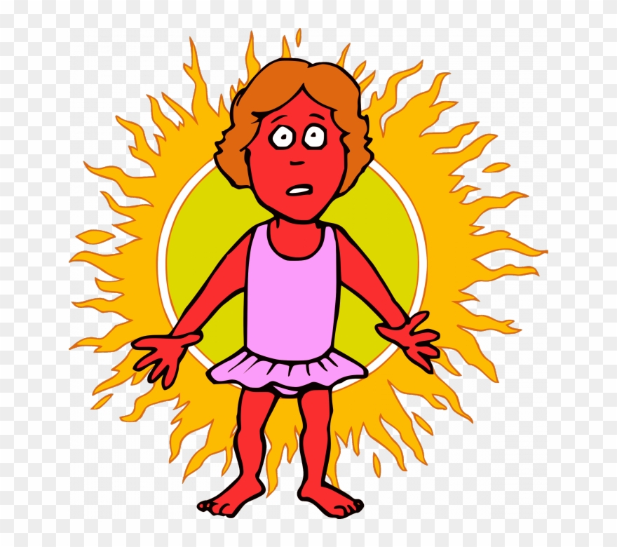 You Should Know This Alternative Remedies For Minor - Sunburn Clipart - Png Download