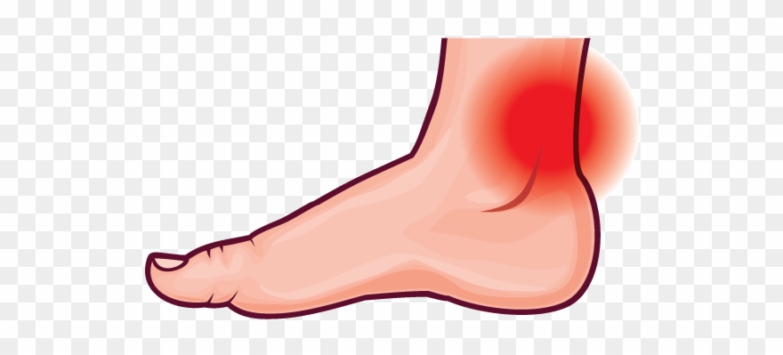 Achilles Tendonitis - Foot Pain Clipart - Png Download