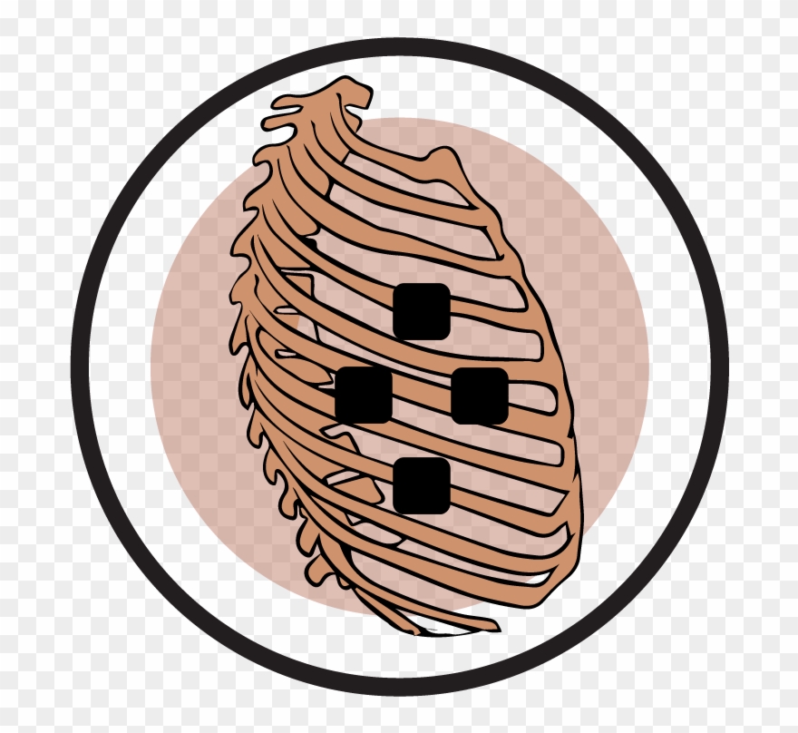 Electrode Pad Placement By Body Part Condition - Electrical Muscle Stimulation Clipart