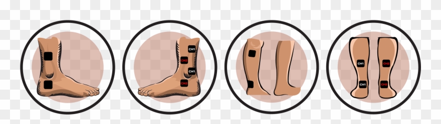 Electrode Pad Placement - Ankle Sprain Tens Unit Clipart