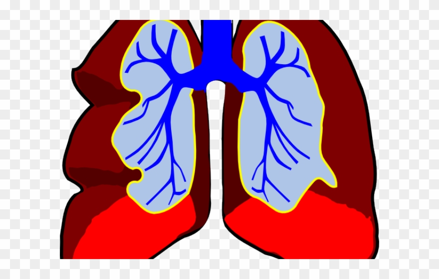Sick Clipart Lung - Lungs Clip Art - Png Download