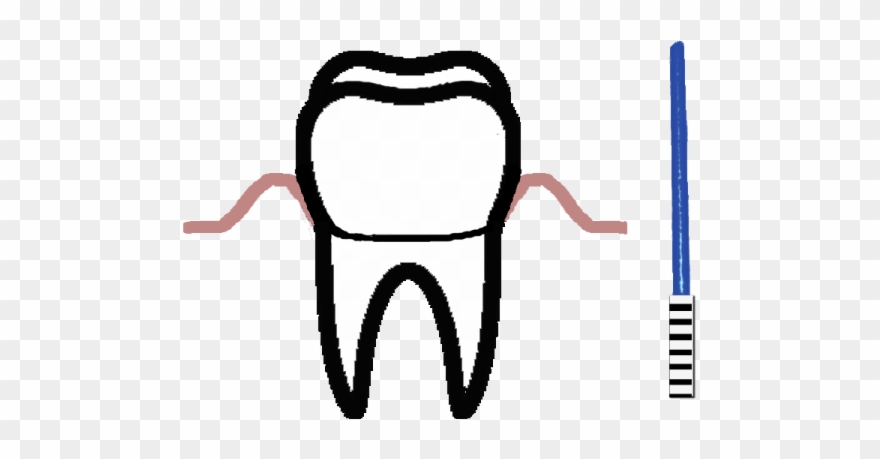 Dental Care And Oral Surgery Often Benefit From Modern - Periodontology Clipart