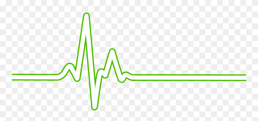 Heart Rate Bpm Ecg - Ecg Transparent Clipart