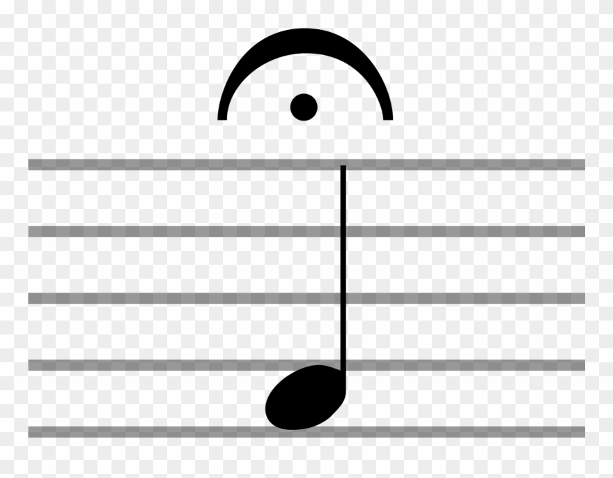 This Symbol Is Called The Fermata, Also Known As The - Fermata Music Clipart