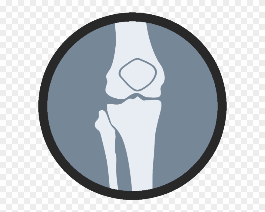 Knee Anatomy - Cartoon Royal Baby Clipart