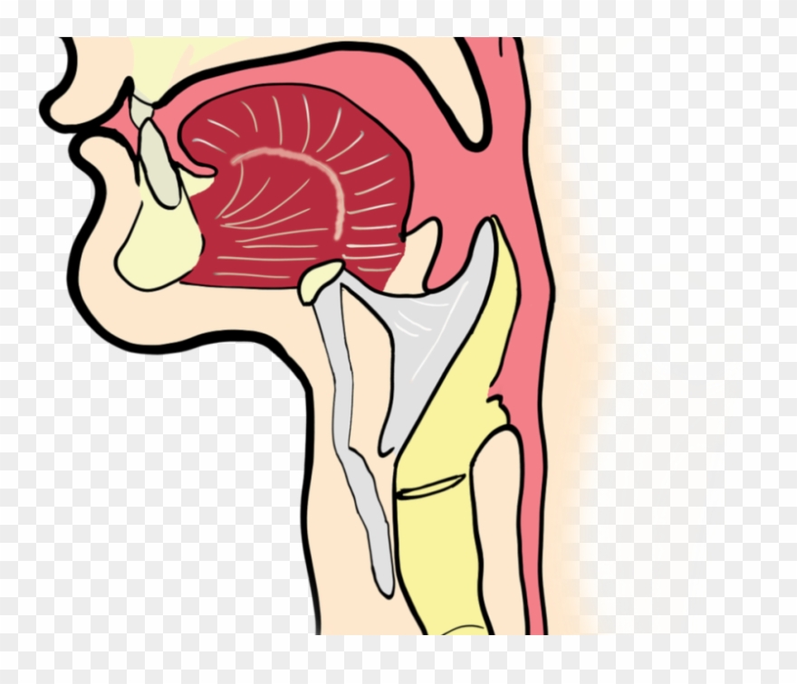 The Laryngeal Cancer Staging - Laringitis Png Clipart