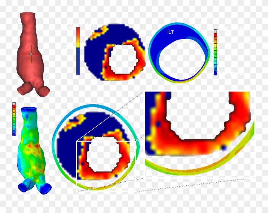 And Strains In The Vascular Tissue, Whereas With Computational - Circle Clipart