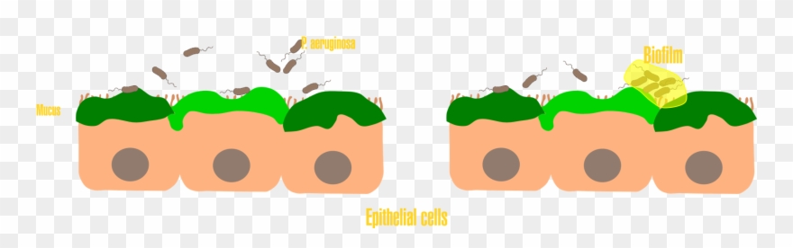 One Of The Main Pathogens Found In An Infection Of - Illustration Clipart