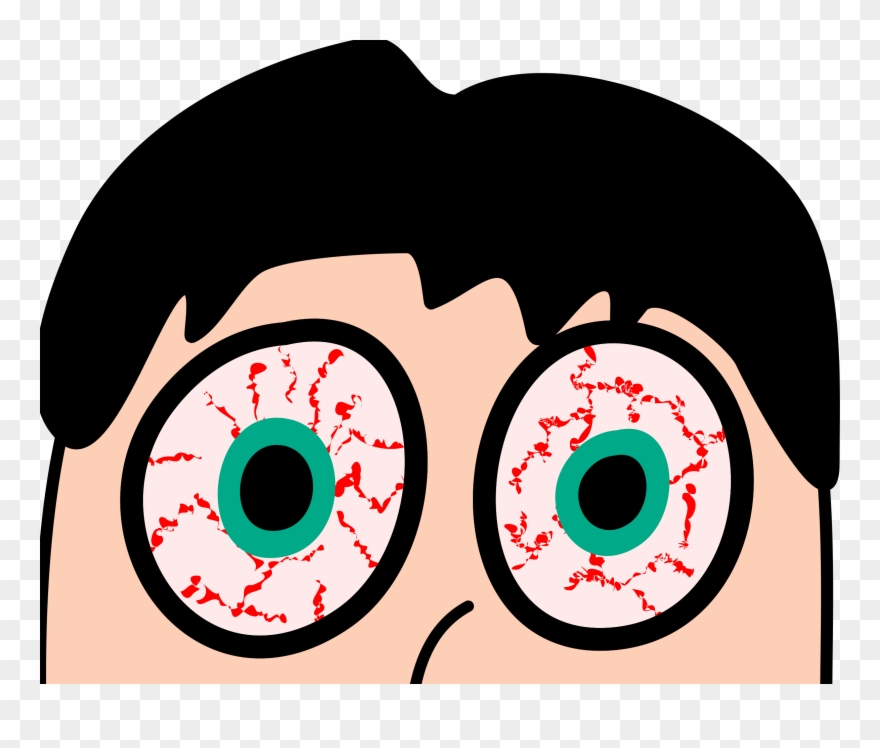 Dry Eye - Dry Eyes Clipart - Png Download