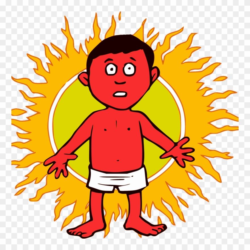 Vector Freeuse Download Dr Ali S Holiday Advice The - Sunburn Clipart Png Transparent Png