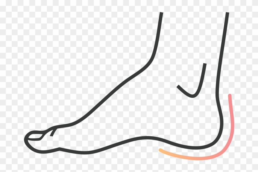 Plantar Fasciitis Clipart