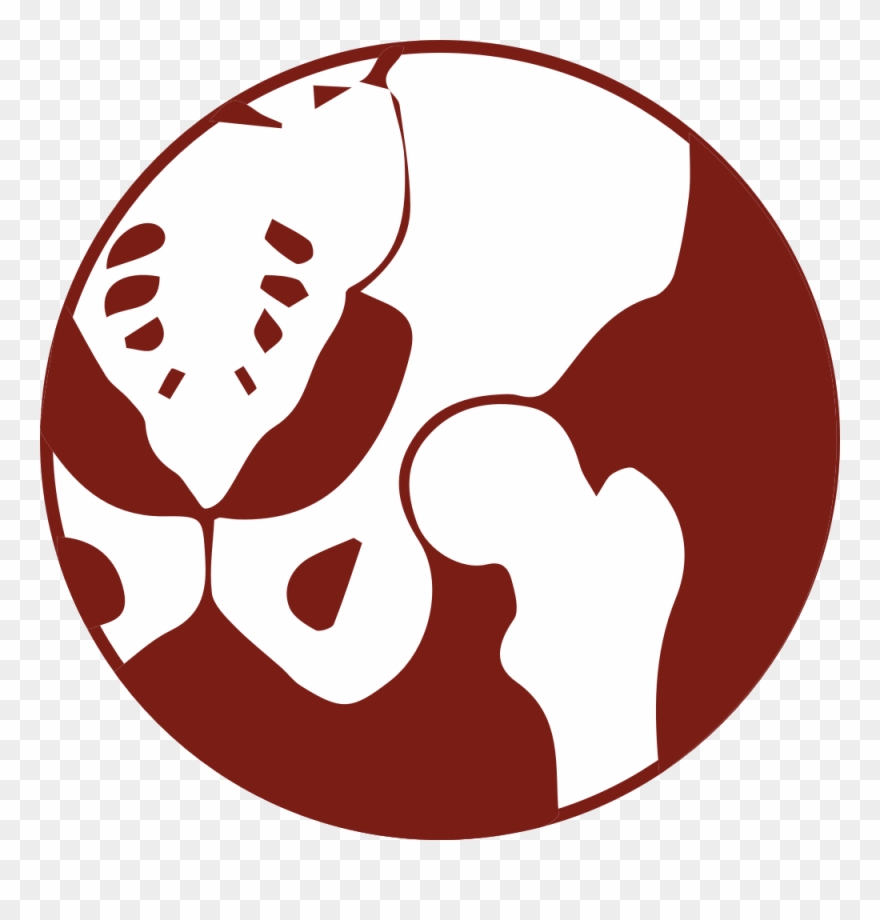 Hip Surgery - Hip Replacement Clipart